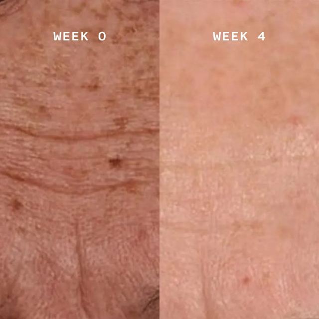 Fine lines, week 0 and week 4